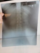 Vintage Radiology X-Ray Picture Sheet 1980s Spine 1987 17