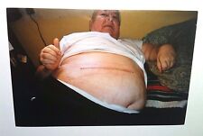 Vintage 2000s Photo Cancer Surgery Grandpa Showing Stomach Scar On Bed Heavy Set picture