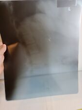Vintage Radiology X-Ray Picture Sheet 1980s Spine Cervical 1987 17
