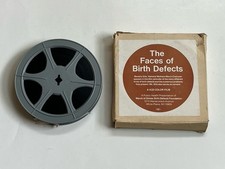 The Faces of Birth Defects March of Dimes - Rare Beverly Sills (4:53 Color Film) picture