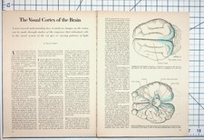The Visual Cortex of the Brain David H. Hubel Article Pages Ephemera picture