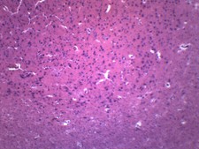 Brain Section - Prepared Microscope Slide - 75x25mm - Eisco Labs picture