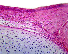 Ciliated Pseudostratified Columnar Epithelium from Respiratory Tissue, picture