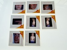 8 COSMETIC SURGERY MEDICAL SLIDES WEIRD STRANGE VINTAGE COLOR 1960s picture