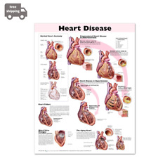 HEART DISEASE ANATOMICAL CHART picture