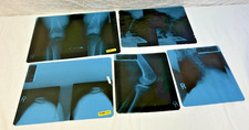 5 Real MRI M R I Film Physical Scan Image Medical X-ray picture