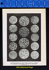 BACTERIA: Typhus, Diphtheria, Anthrax, Leprosy, Bacilli: - 1922 Page of History picture