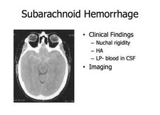 308 slide TBI TRAUMATIC BRAIN INJURY Treatment PowerPoint Presentation on CD  picture