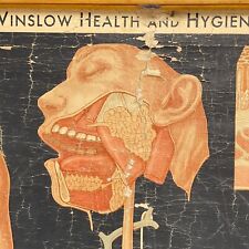 Vintage 30's Winslow Digestion Wall Chart Denoyer Geppert Medical Anatomy Occult picture