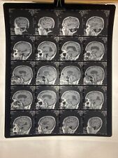 MRI CT Brain Scans X-Rays Medical Skull Prop Halloween Lot of 10 (A1) picture