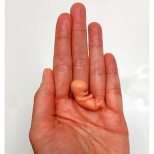 10 Weeks Baby Fetus, Stage of Fetal Development (Memorial/Miscarriage/Keepsake) picture
